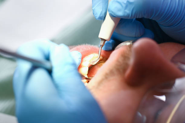 Best Chipped Tooth Repair Near Me  in Middletown, DE