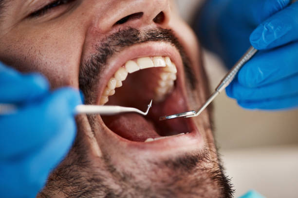 Best Dentist for Tooth Abscess  in Middletown, DE