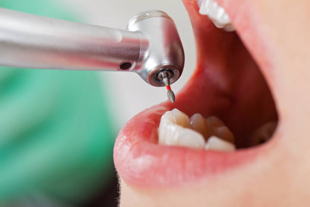 Best Tooth Infection Emergency Dentist  in Middletown, DE